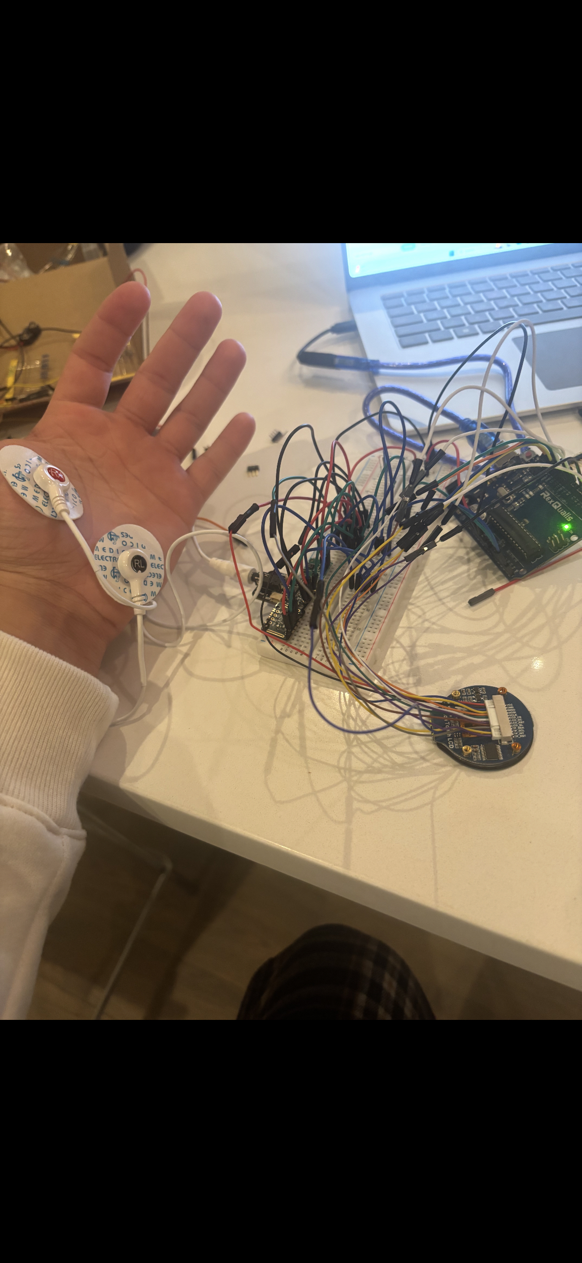 Emotion-Detecting Watch